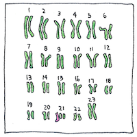 Illustration of Inborn errors of metabolism