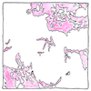 Illustration of Tuberculosis vaccine